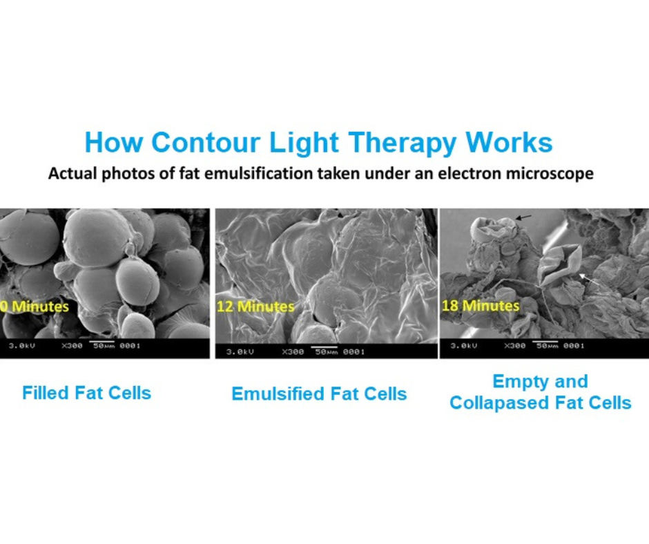 Contour Light Contour Light / Laser Lipo